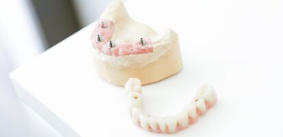 Implantologie / Fast & Fix der Zahnarztpraxis in Saarbrücken